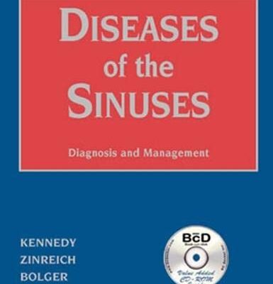 Diseases Of The Sinuses Diagnosis And Management