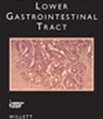 Cancer of the Lower Gastrointestinal Tract (BC DECKER)