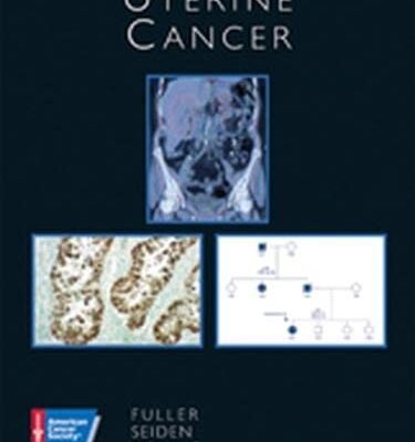 UTERINE CANCER (AGENCY/DISTRIBUTED)