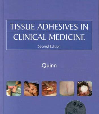 Tissue Adhesives In Clinical Medicine