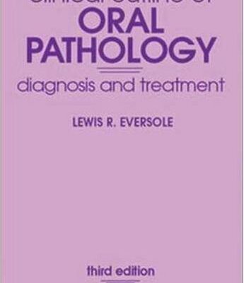 Clinical Outline Of Oral Pathology