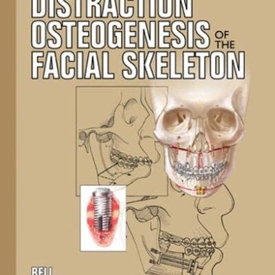 Distraction Osteogenesis of the Facial Skeleton