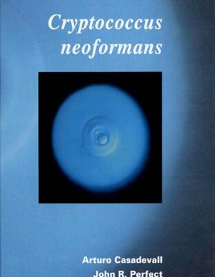 Cryptococcus Neoformans: Molecular Pathogenesis and Clinical Management