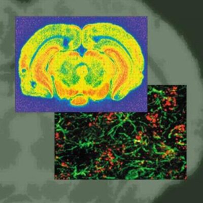 Borna Disease Virus: Role in Neurobehavioual Diseases