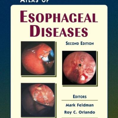 ATLAS OF ESOPHAGEAL DISEASES 2ED