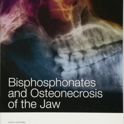 Bisphosphonates and Osteonecrosis of the Jaw, Volume 1218 (Annals of the New York Academy of Sciences)