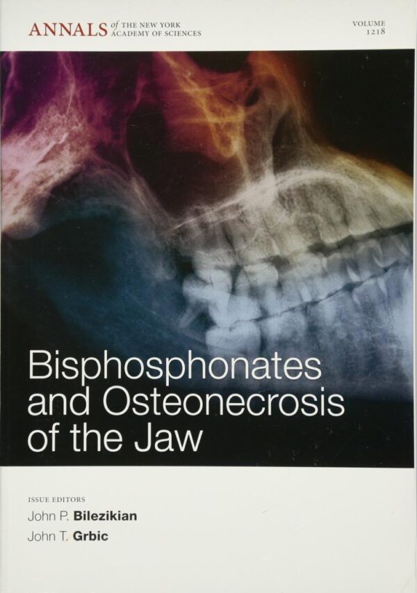 Bisphosphonates and Osteonecrosis of the Jaw, Volume 1218 (Annals of the New York Academy of Sciences)