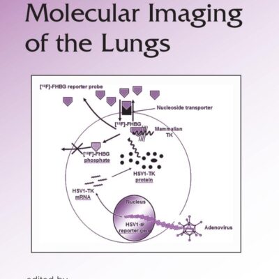 MOLECULAR IMAGING OF THE LUNGS