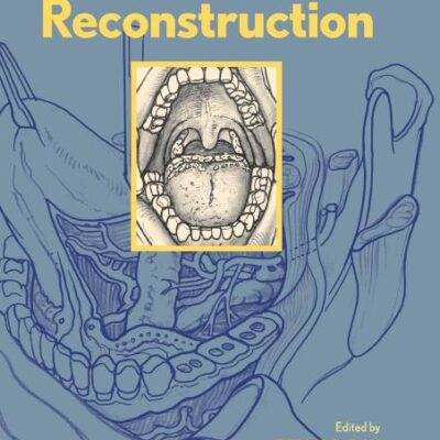 Oral Cavity Reconstruction(2006)