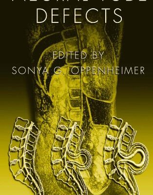 Neural Tube Defects (Pediatric Habilitation)