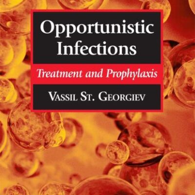 OPPORTUNISTIC INFECTIONS: TREATMENT AND PROPHYLAXIS (INFECTIOUS DISEASE)