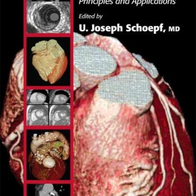 Ct of the Heart: Principles and Applications (Contemporary Cardiology)