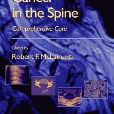 CANCER IN THE SPINE: COMPREHENSIVE CARE (HB) (Current Clinical Oncology)