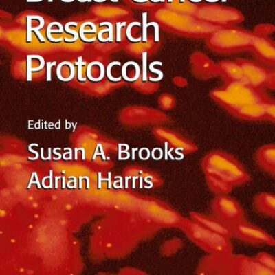 BREAST CANCER RESEARCH PROTOCOLS (METHODS IN MOLECULAR MEDICINE, VOLUME 120)