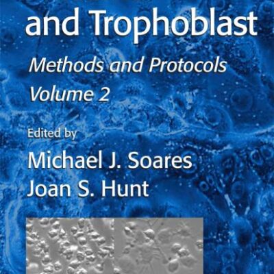 Placenta and Trophoblast: Methods and Protocols, Volume Ii
