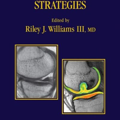 CARTILAGE REPAIR STRATEGIES (HB)
