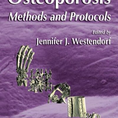 Osteoporosis (Hb): Methods and Protocols: 455 (Methods in Molecular Biology)
