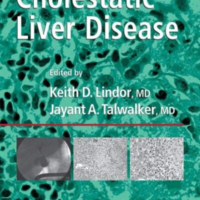CHOLESTATIC LIVER DISEASE (CLINICAL GASTROENTEROLOGY)