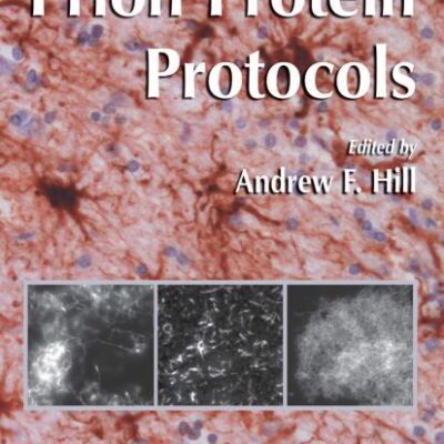 PRION PROTEIN PROTOCOLS (METHODS IN MOLECULAR BIOLOGY): 459