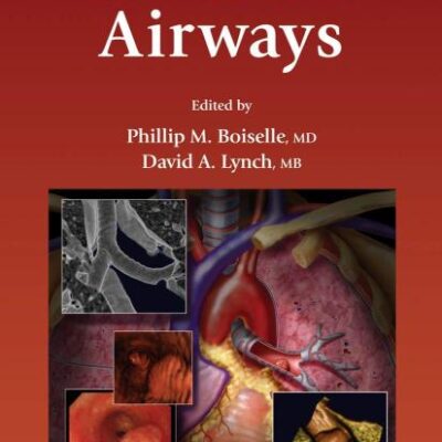 CT OF THE AIRWAYS