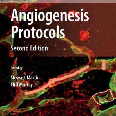 ANGIOGENESIS PROTOCOLS: 467 (Methods in Molecular Biology)