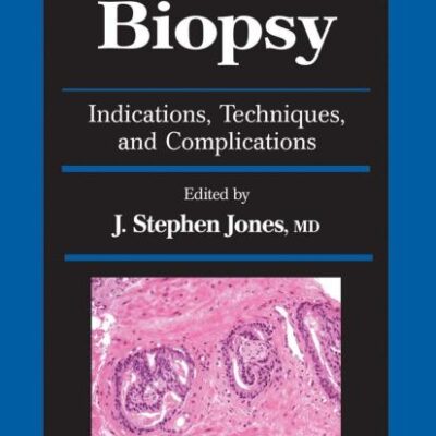 PROSTATE BIOPSY (HB): Indications, Techniques, and Complications (Current Clinical Urology)