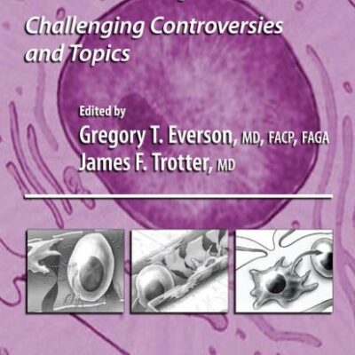 LIVER TRANSPLANTATION: Challenging Controversies and Topics (Clinical Gastroenterology)