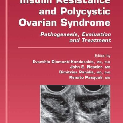 INSULIN RESISTANCE AND POLYCYSTIC OVARIAN SYNDROME: PATHOGENESIS, EVALUATION, AND TREATMENT