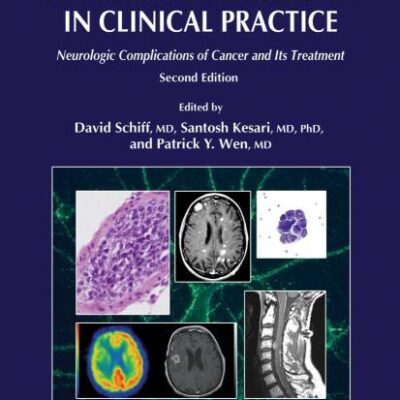 Cancer Neurology In Clinical Practice 2Ed Neurologic Complications Of Cancer And Its Treatment (Hb 2008)