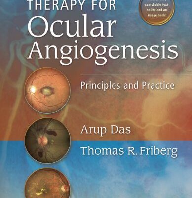 Therapy for Ocular Angiogenesis: Principles and Practice