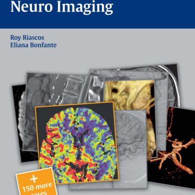 Neuro Imaging: RedCases (RadCases)