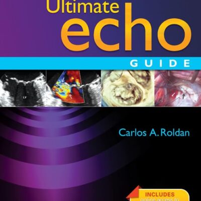 Ultimate Echo Guide