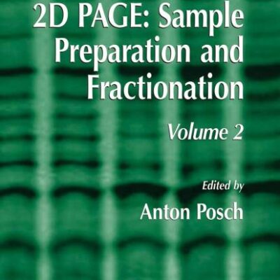 2D PAGE: SAMPLE PREPARATION AND FRACTIONATION (HB): Volume 2: 425 (Methods in Molecular Biology)