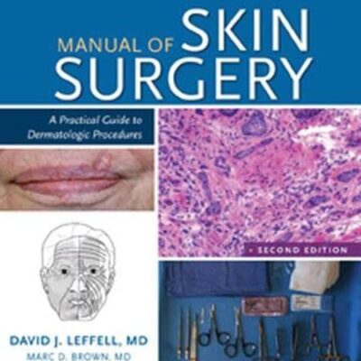 Manual of Skin Surgery: A Practical Guide to Dermatologic Procedures