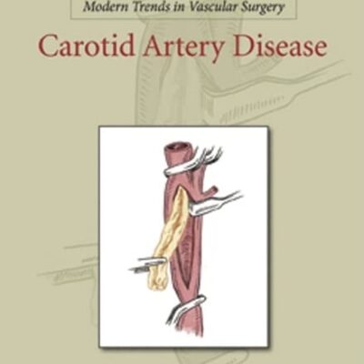 Modern Trends in Vascular Surgery: Carotid Artery Disease (AGENCY/DISTRIBUTED)