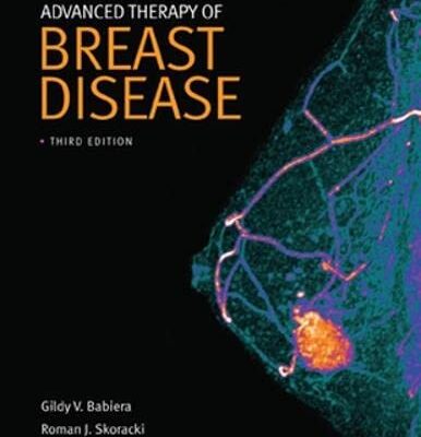 Advanced Therapy of Breast Disease