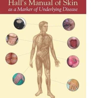 Hall's Manual of Skin as a Marker of Underlying Disease