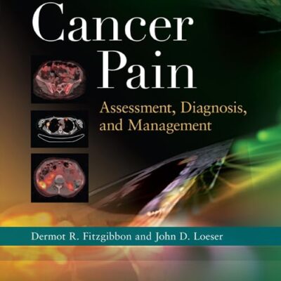 Cancer Pain: Assessment, Diagnosis, and Management