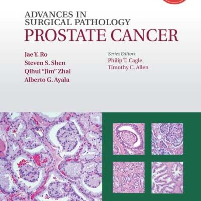 Advances in Surgical Pathology: Prostate Cancer