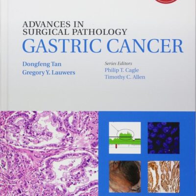 Advances in Surgical Pathology: Gastric Cancer