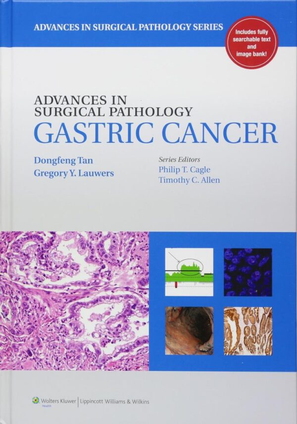 Advances in Surgical Pathology: Gastric Cancer