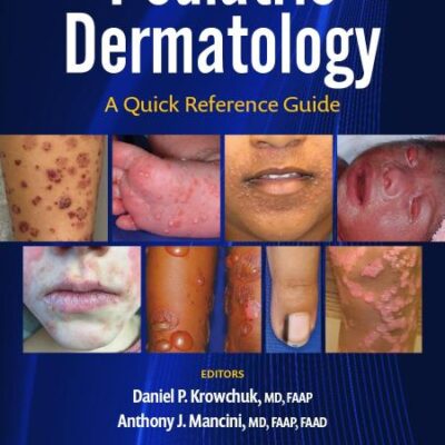 Pediatric Dermatology: A Quick Reference Guide