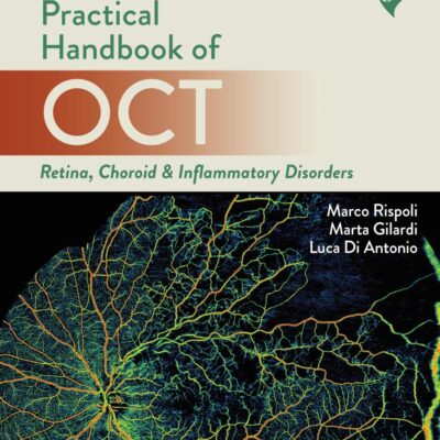 PRACTICAL HANDBOOK OF OCT RETINA, CHOROID & INFLAMMATORY DISORDERS