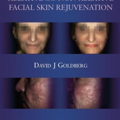 Ablative And Non-Ablative Facial Rejuvenation