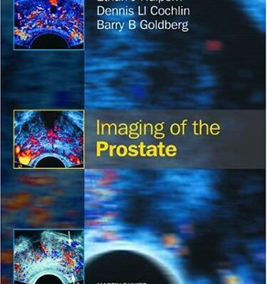 Imaging of the Prostate