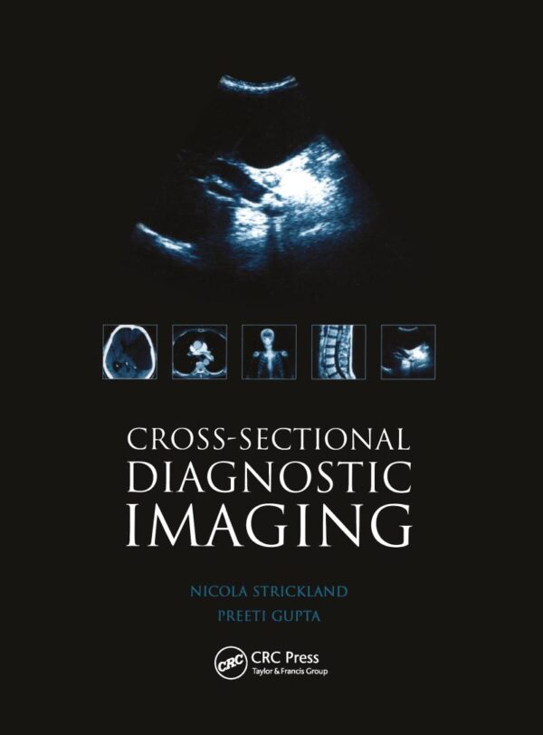 Cross-sectional Diagnostic Imaging: Cases for Self Assessment