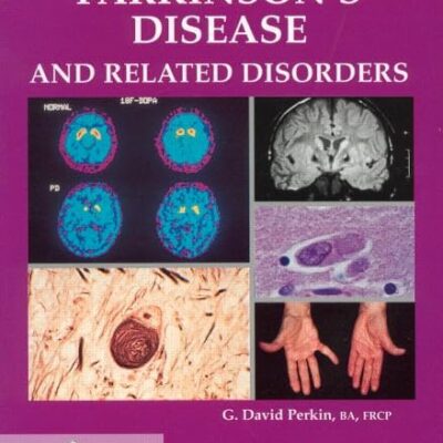 An Illustrated Pocketbook of Parkinson’s Disease and Related Disorders