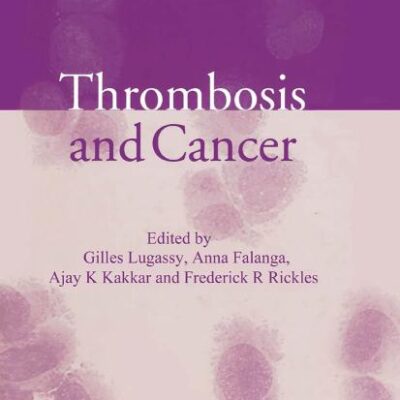 Thrombosis and Cancer
