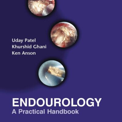 Endourology: A Practical Handbook