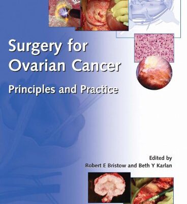 Surgery for Ovarian Cancer: Principles and Practice